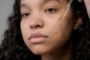 Ginger Honey Rescue Spot Treatment